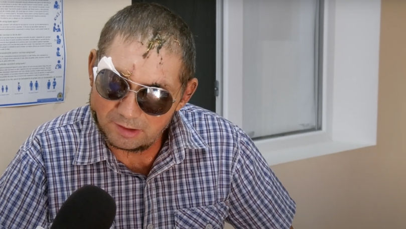 Bărbatul mutilat de câini la Baimaclia, externat din spital. Ce povestește