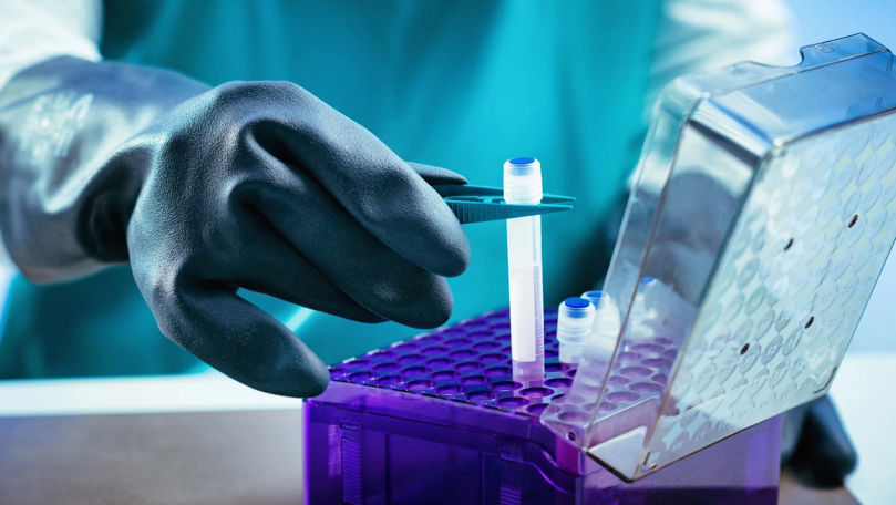 Activitatea băncilor biologice umane va fi reglementată de o lege specială