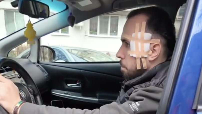 Taximetristul împușcat în Capitală povestește cum a fost atacat