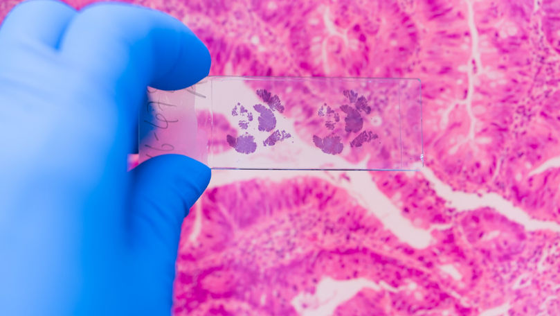 Avertismentul OMS: Două produse folosite frecvent, clasificate drept cancerigene