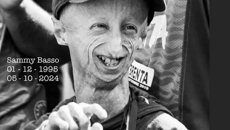 Sammy Basso, cel mai longeviv om diagnosticat cu progeria, a murit