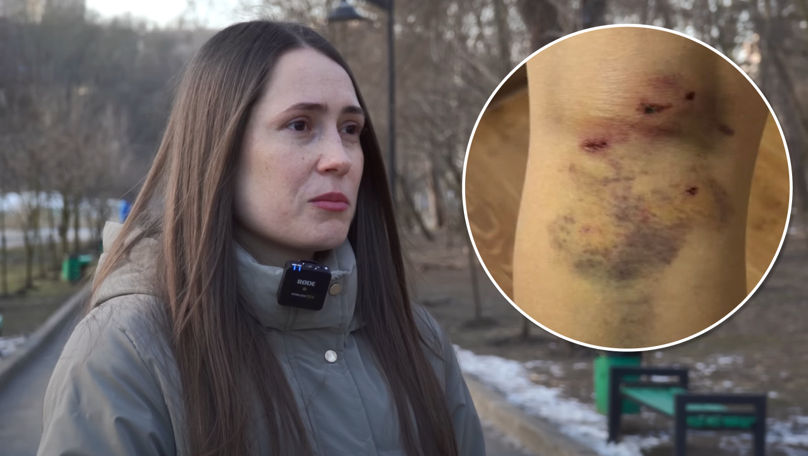O femeie, atacată de un câine în Parcul Valea Trandafirilor din Capitală