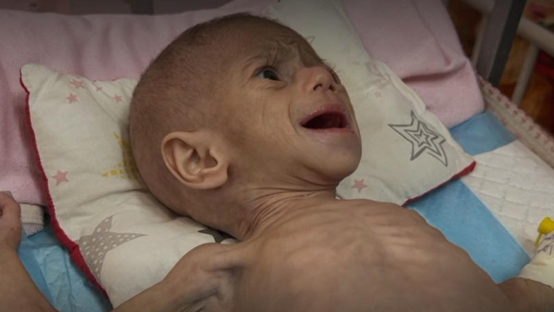 Un cameraman s-a întors în Fâșia Gaza ca să afle soarta unei fetițe subnutrite