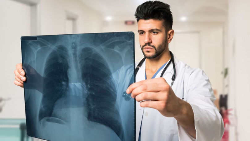 În raionul Căușeni va fi organizat un screening pulmonar gratuit