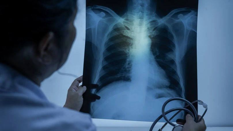 Peste 1.000 de moldoveni au murit anul trecut din cauza pneumoniei