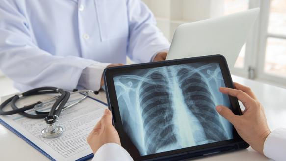 Screening pulmonar în sate: Medicii verifică starea de sănătate a locuitorilor