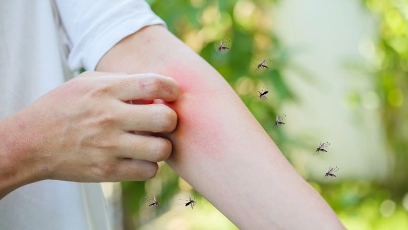 De ce nu e bine să ne scărpinăm după ce ne-a ciupit o insectă
